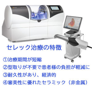 奈良の松田歯科医院のセレック治療の特徴